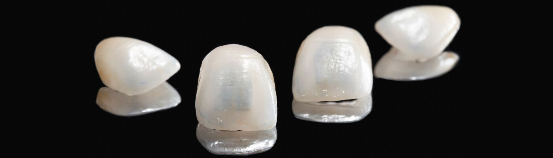 veneers